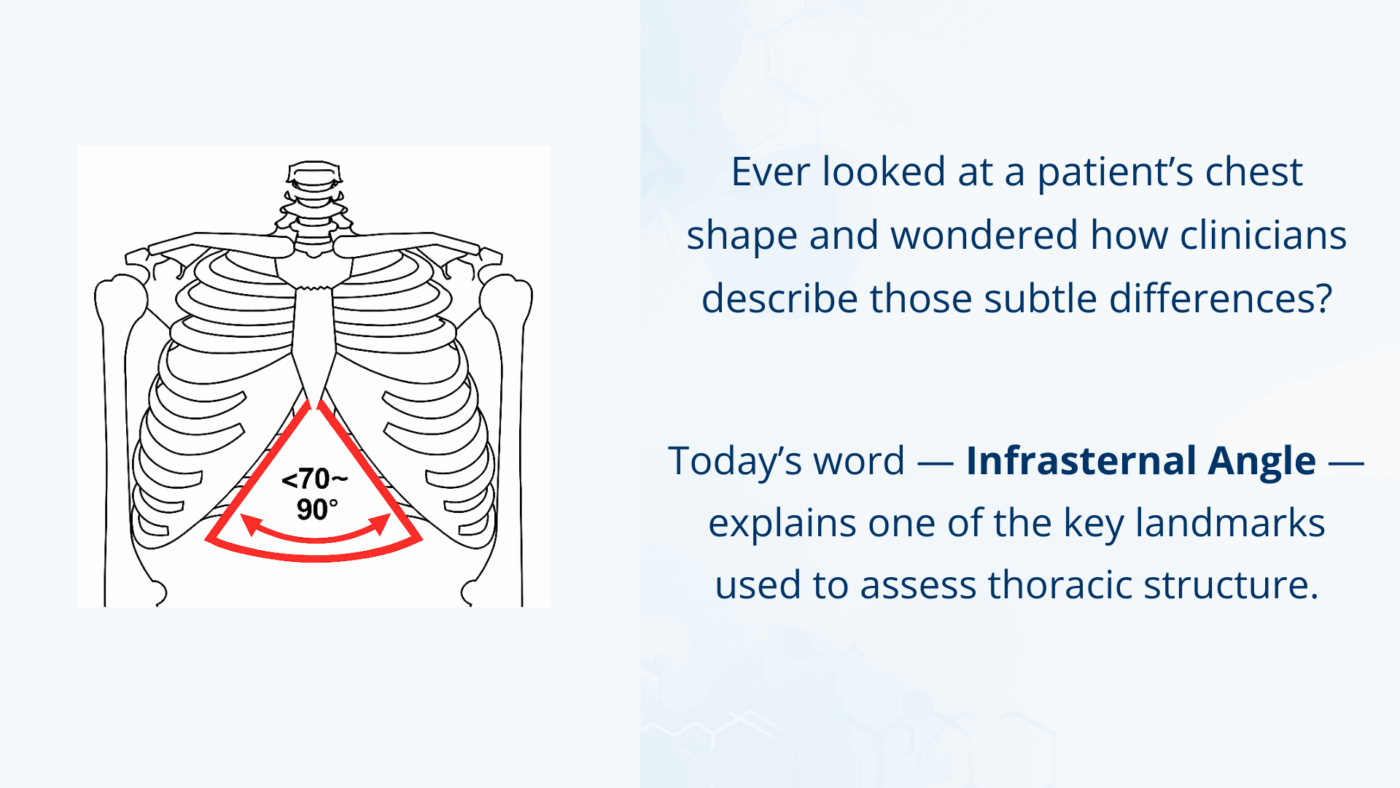 Illustration of the infrasternal angle below the sternum