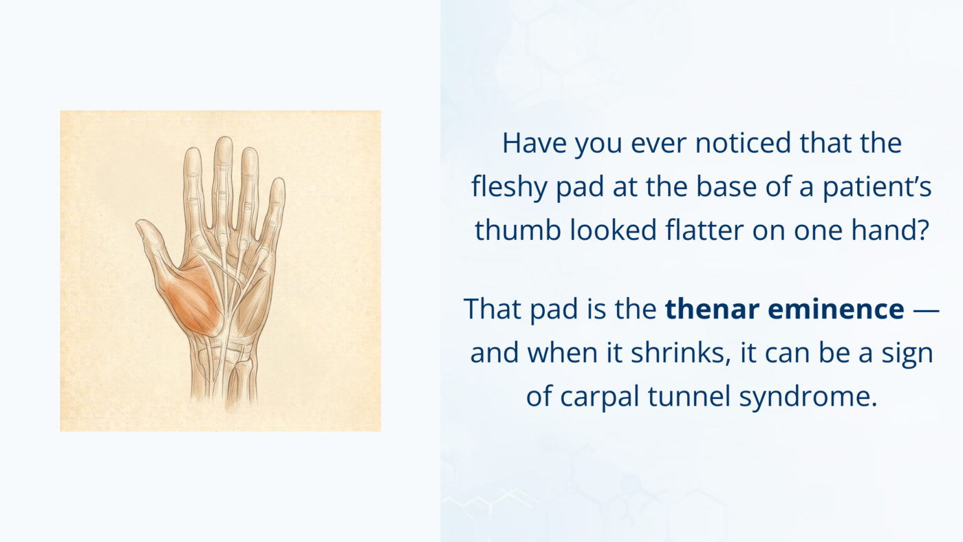 Medical illustration of the palm highlighting the thenar eminence, the fleshy bulge at the base of the thumb.